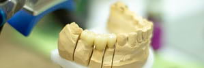 Protetica dentara Bucuresti